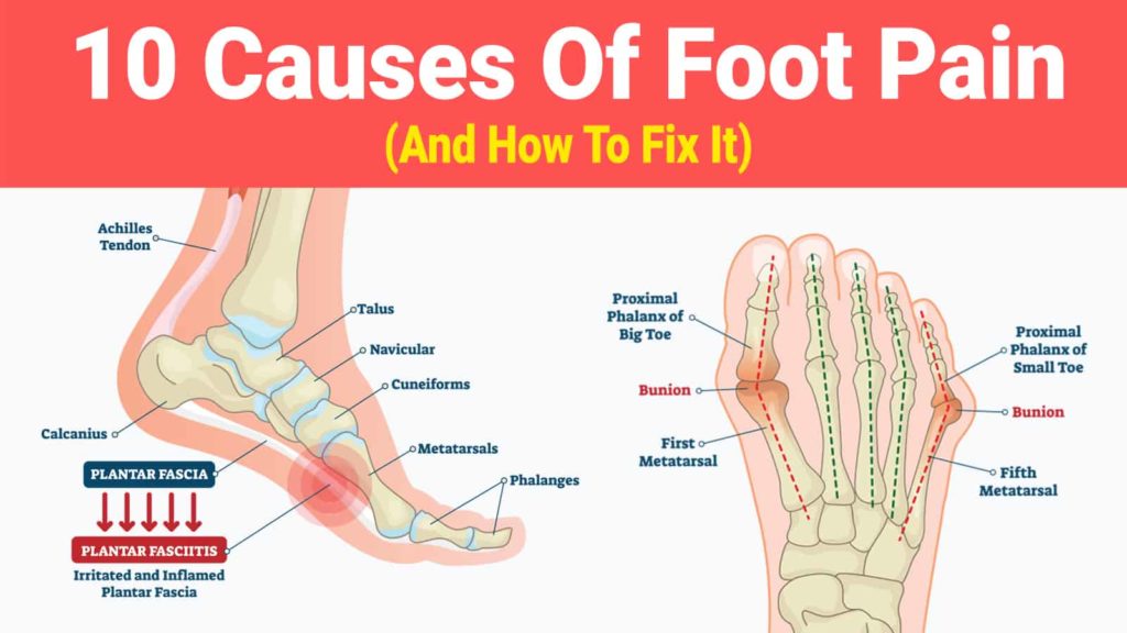 sudden foot arch pain