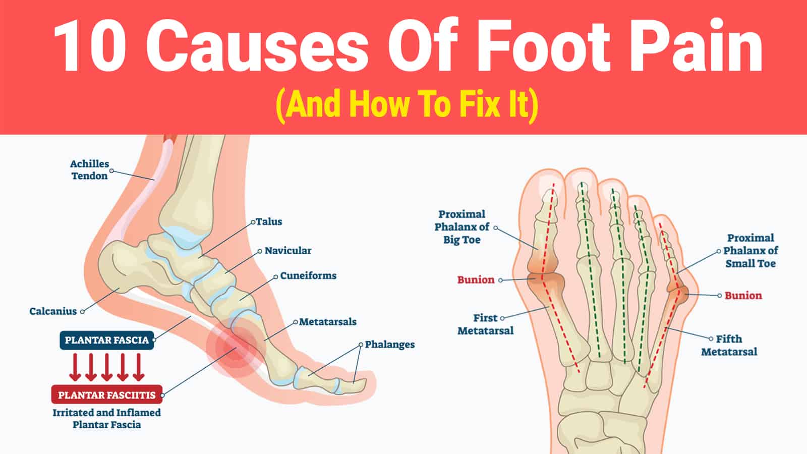 10 Causes Of Foot Pain And How To Fix It 