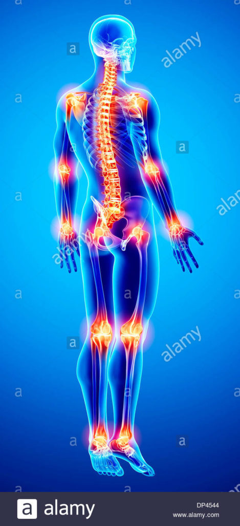 JOINT PAIN