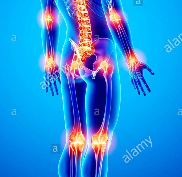 JOINT PAIN